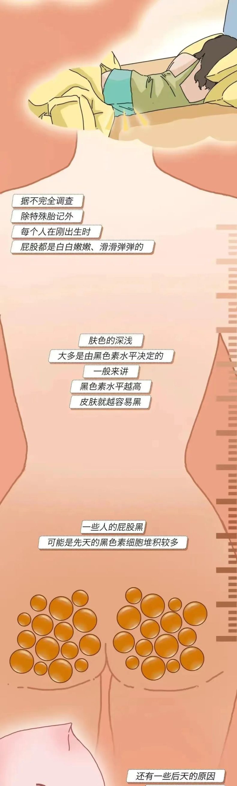 为什么女生屁股上有两团“黑印子”？有几个人知道